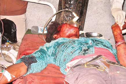 Dhani Ram Chaudhari...injured in an ambush set up by the Maoists in a bridge over Tulbulia Khola near Murgiya Bazaar of Rupandahi's Parhoha VDC