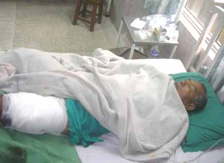 Ram Bahadur Rana undergoes treatment in Midwest Regional Hospital, Pokhara. 