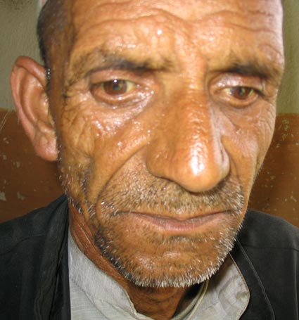 From the unlocking ceremony of Internally Displaced Citizen Toyanath Poudel house